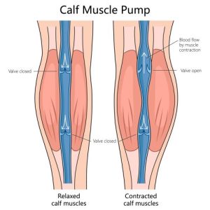 calf muscle pump (soleus)